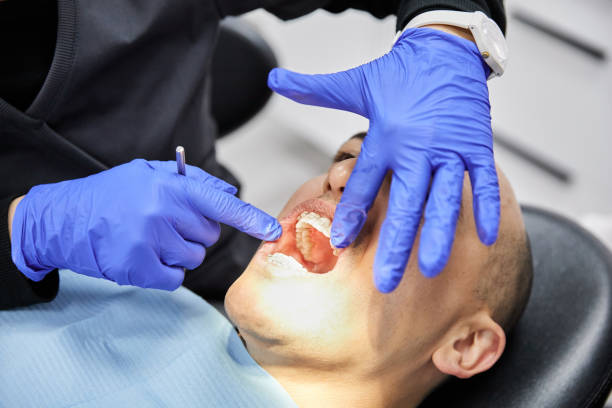 Best Emergency Dentist for Lost Fillings or Crowns in East Oakdale, CA